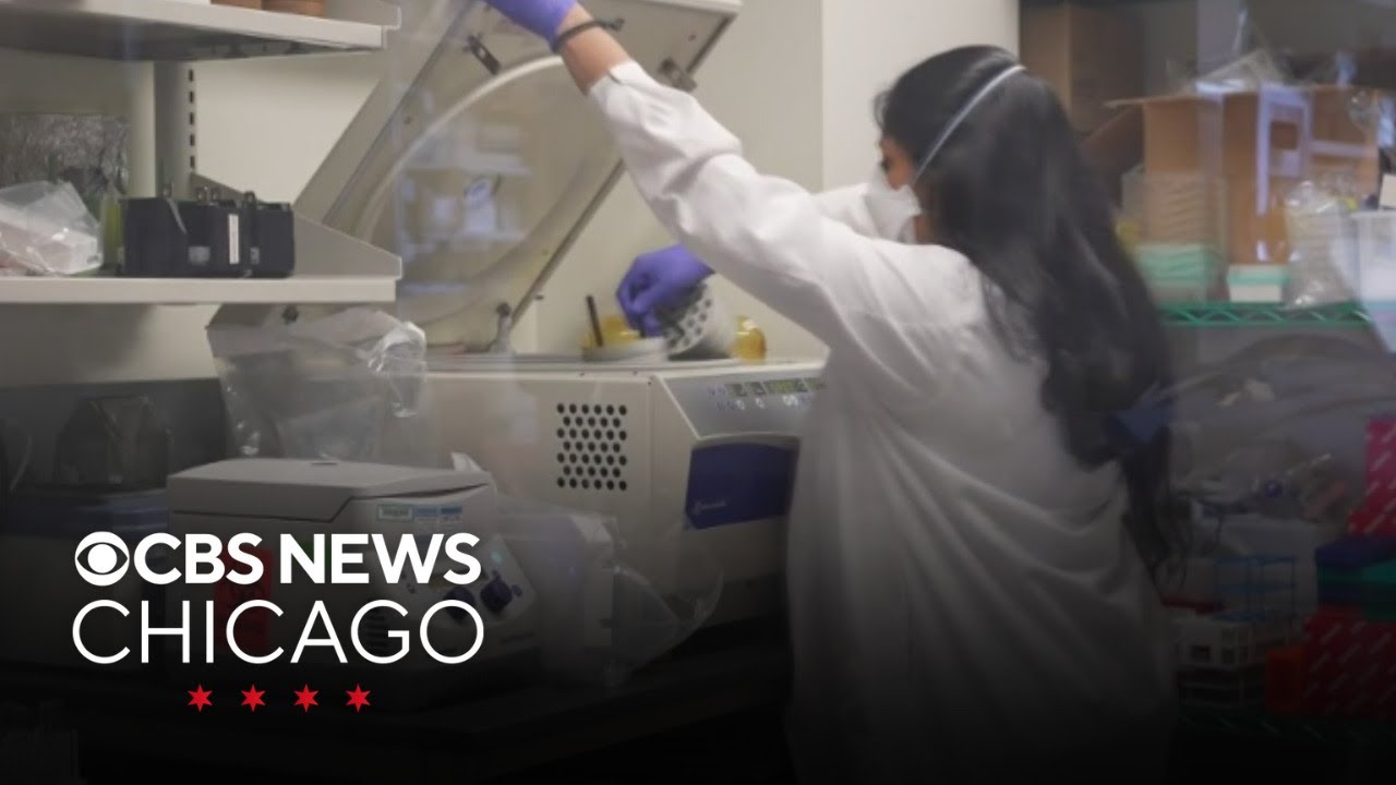 Virus may be trigger for Parkinson's disease, Northwestern Medicine researchers find