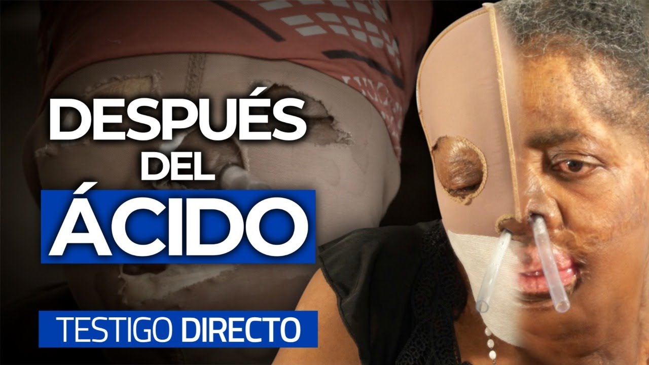 CONSUELO: la bella detrás de la máscara - Testigo Directo
