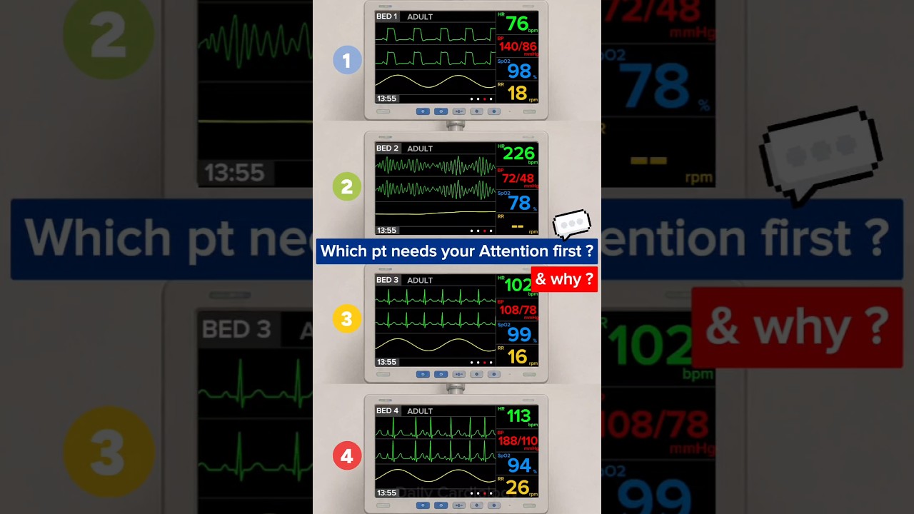 Which Patient Needs Your Attention FIRST? Can You Prioritize Correctly? #ecg #cardiology #emergency