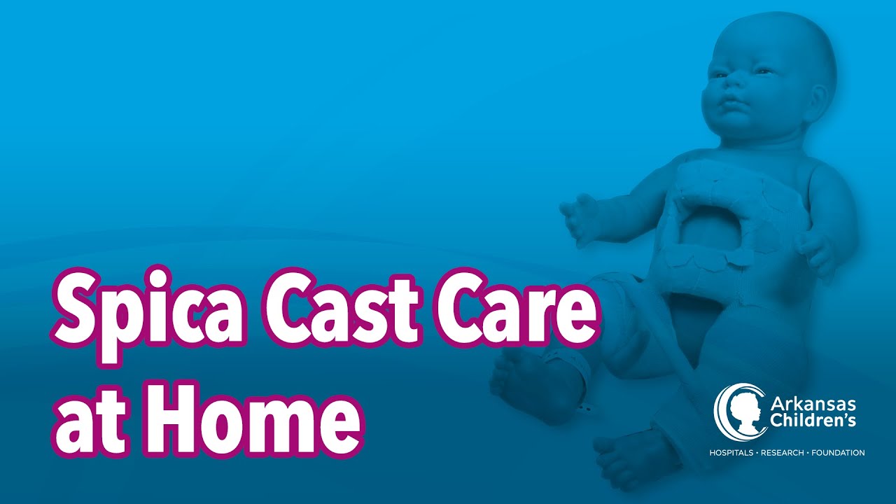 Foster Parent Education - Spica Cast Care at Home: How to Petal, Diaper, and Transport Your Child