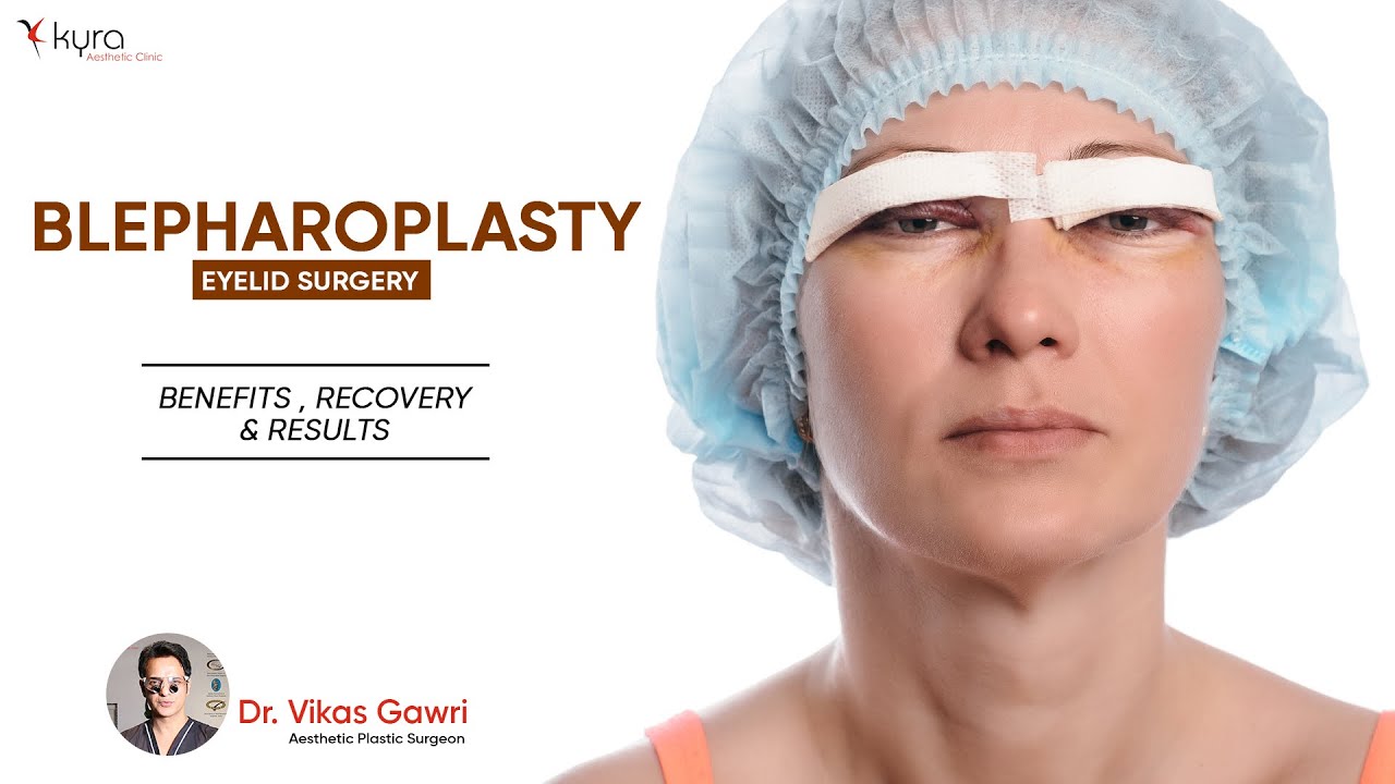 Blepharoplasty Eyelids surgery Explained: Benefits, Recovery, and Results - Dr Vikas Gawri