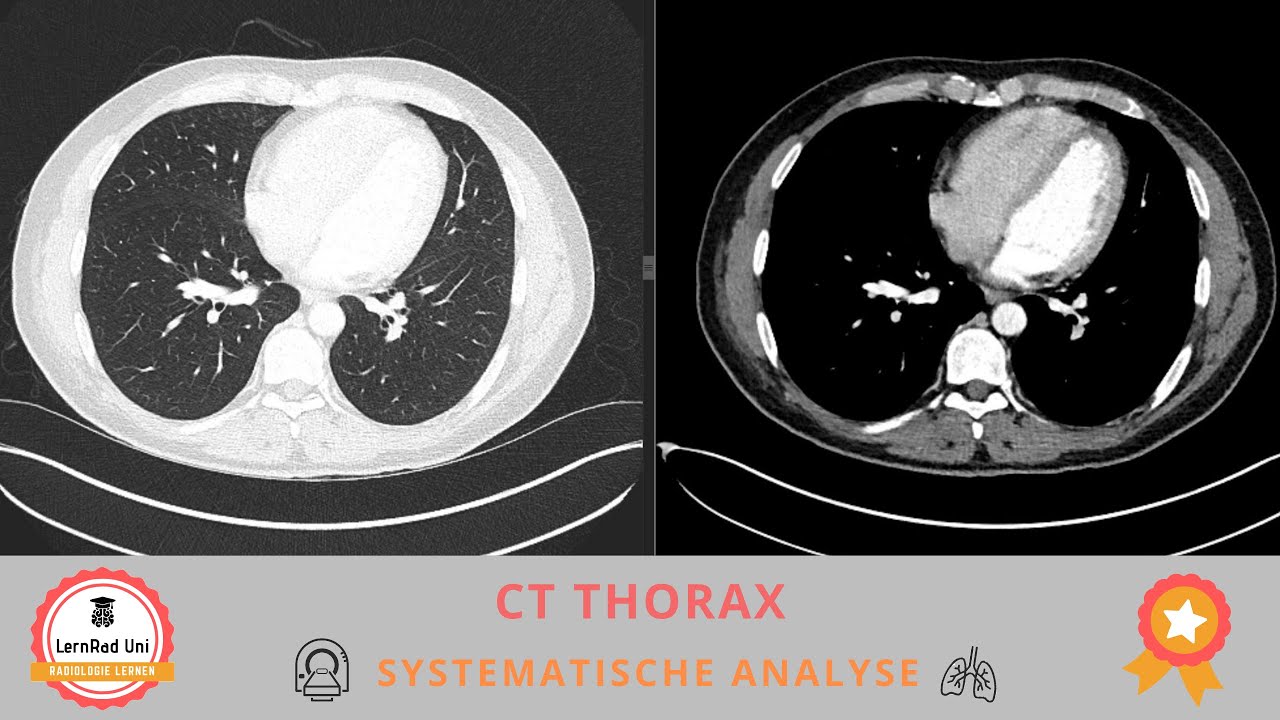 CT Thorax - Systematische Bildanalyse