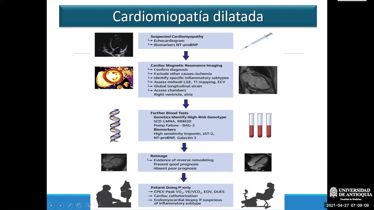 Resonancia Cardiaca en Insuficiencia Cardiaca - Dr. Juan Pablo Flórez