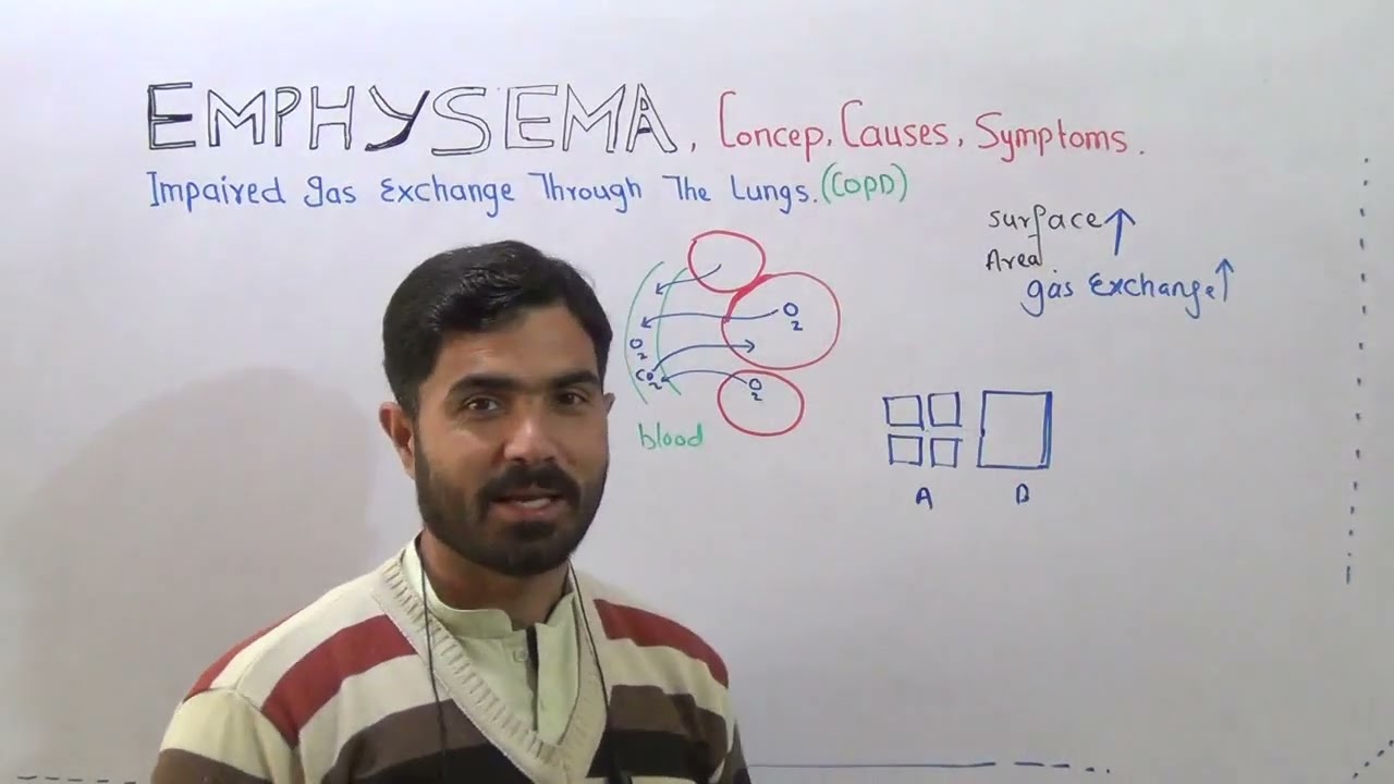 L-14 Emphysema Concept, causes and symptoms