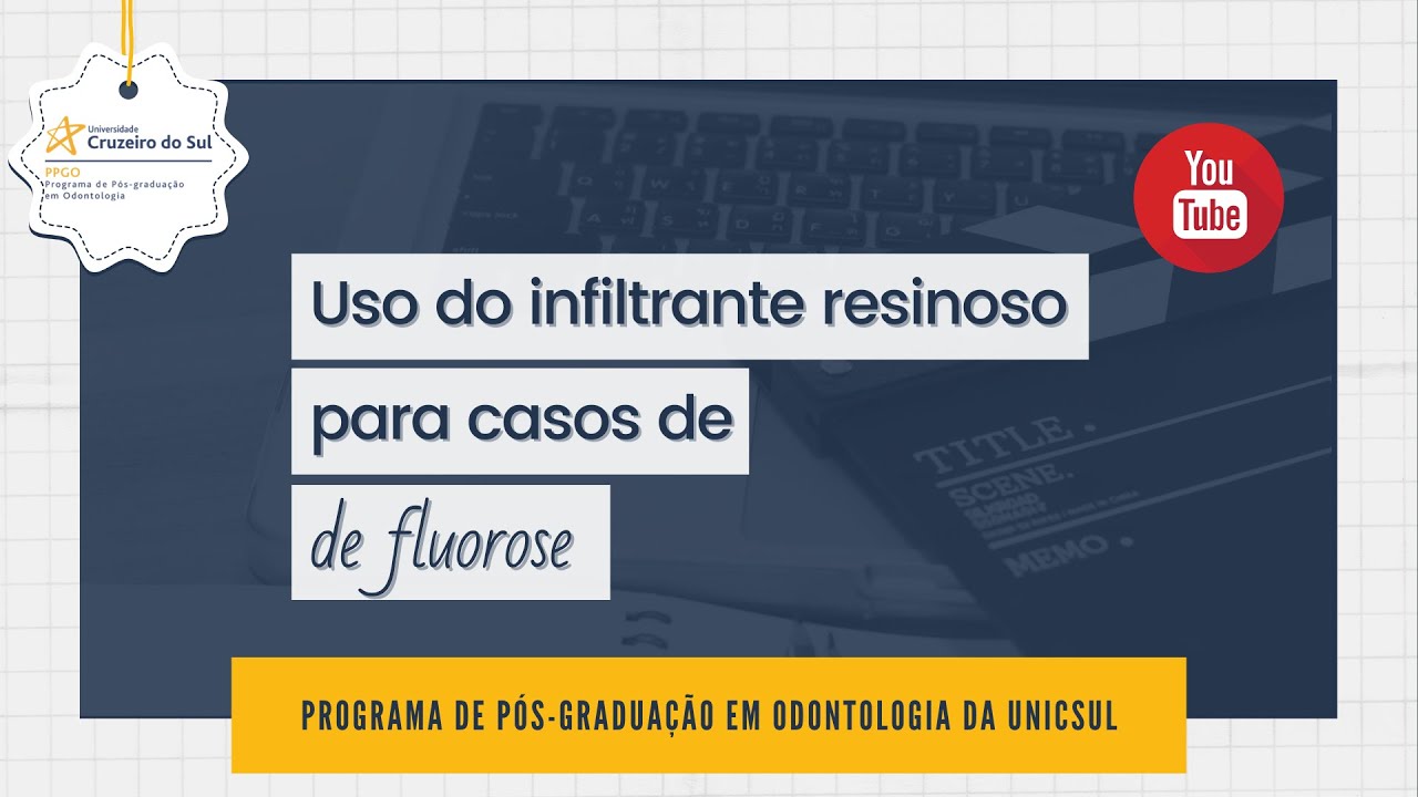 Uso de Infiltrante Resinoso para Casos de Fluorose