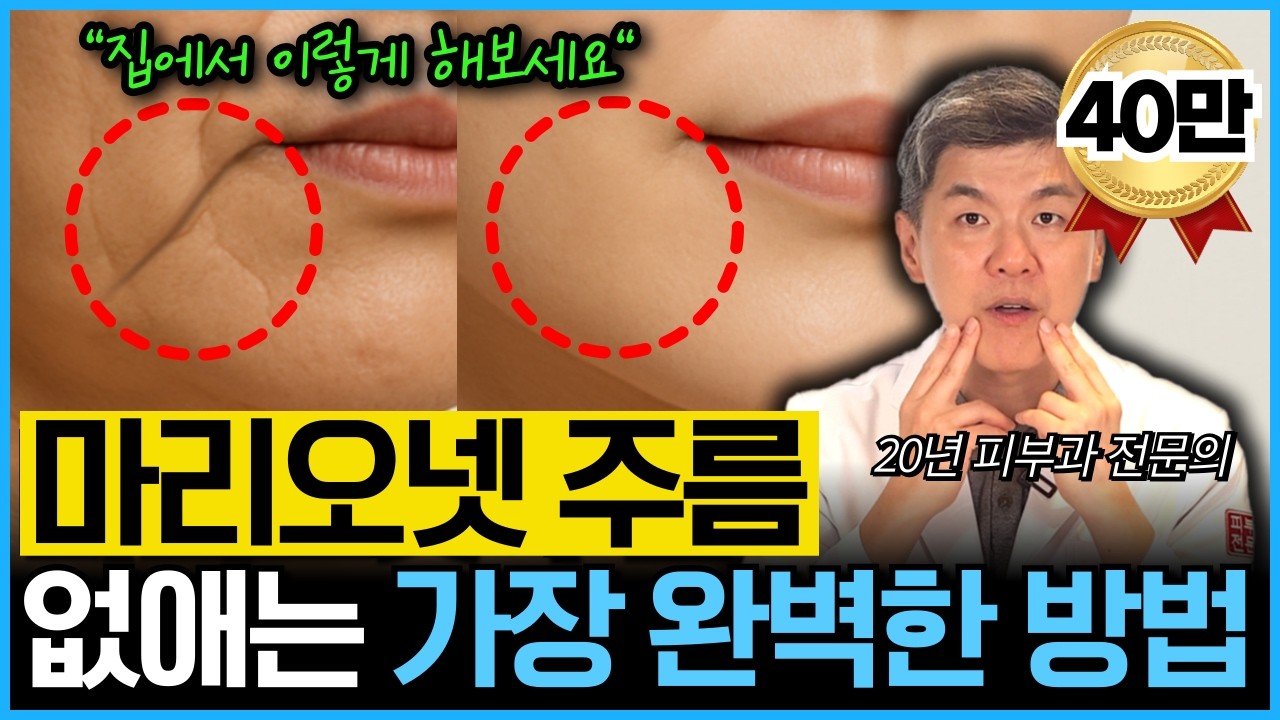 20년차 피부과 전문의가 말하는 마리오네트 주름 없애는 방법! 수술없이 마리오넷주름 간단하게 해결하세요