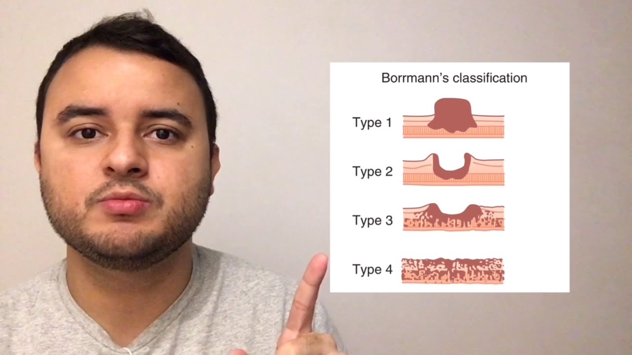 Classificação de BORRMANN