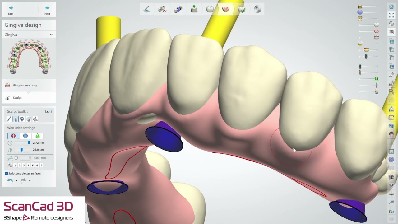 3shape UAOX 03-03-2026 K