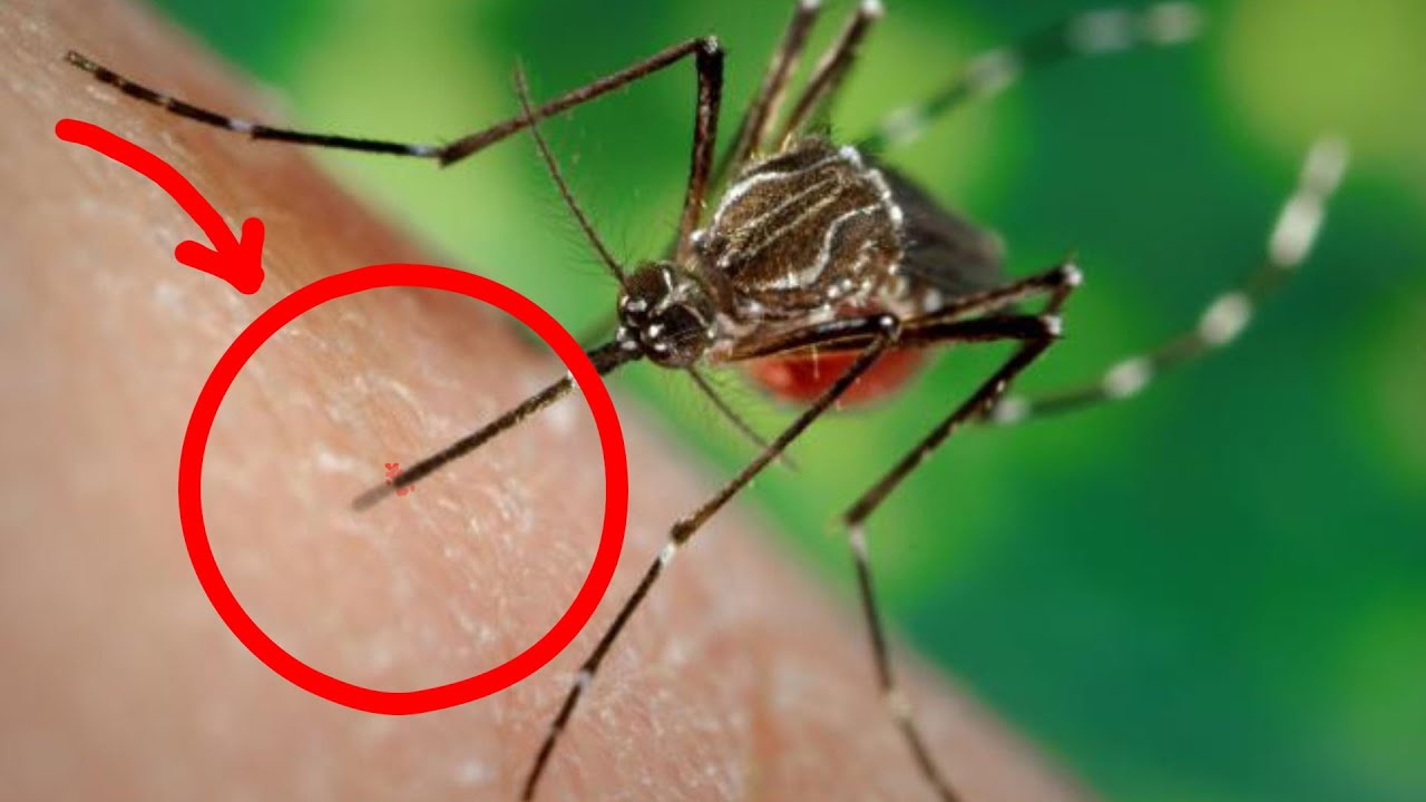 Picada de mosquito no MICROSCÓPIO (e outras ideias que vou roubar)