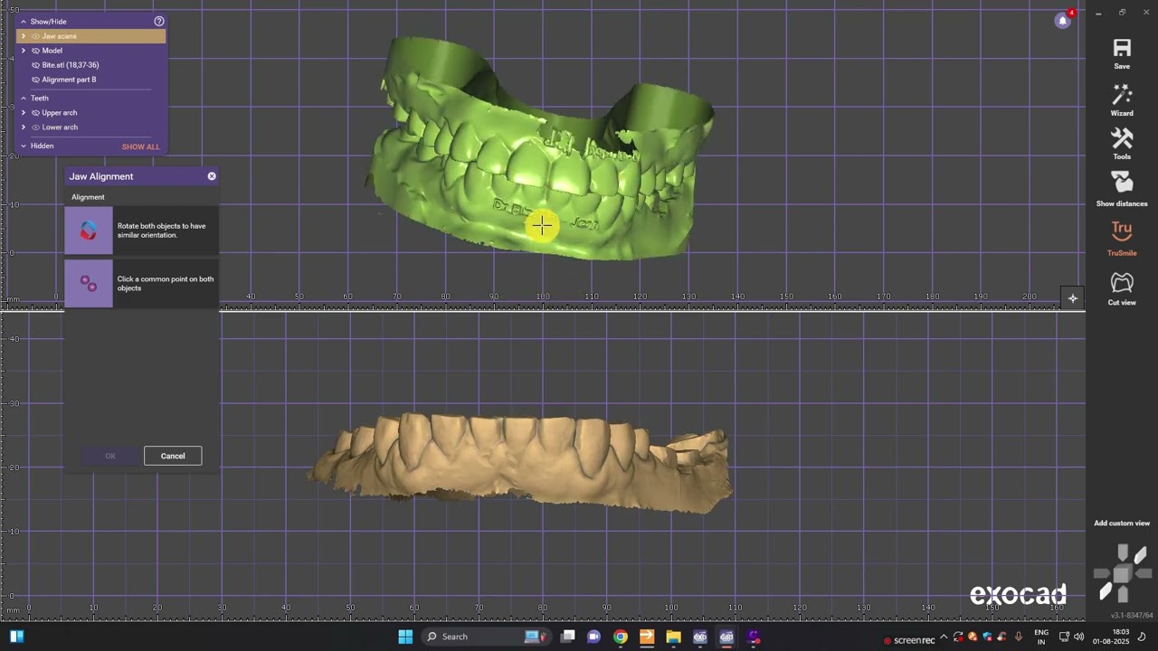 How To align Bite in Exocad? #exocad #digitaldentistry #dentist #dentalprosthesis