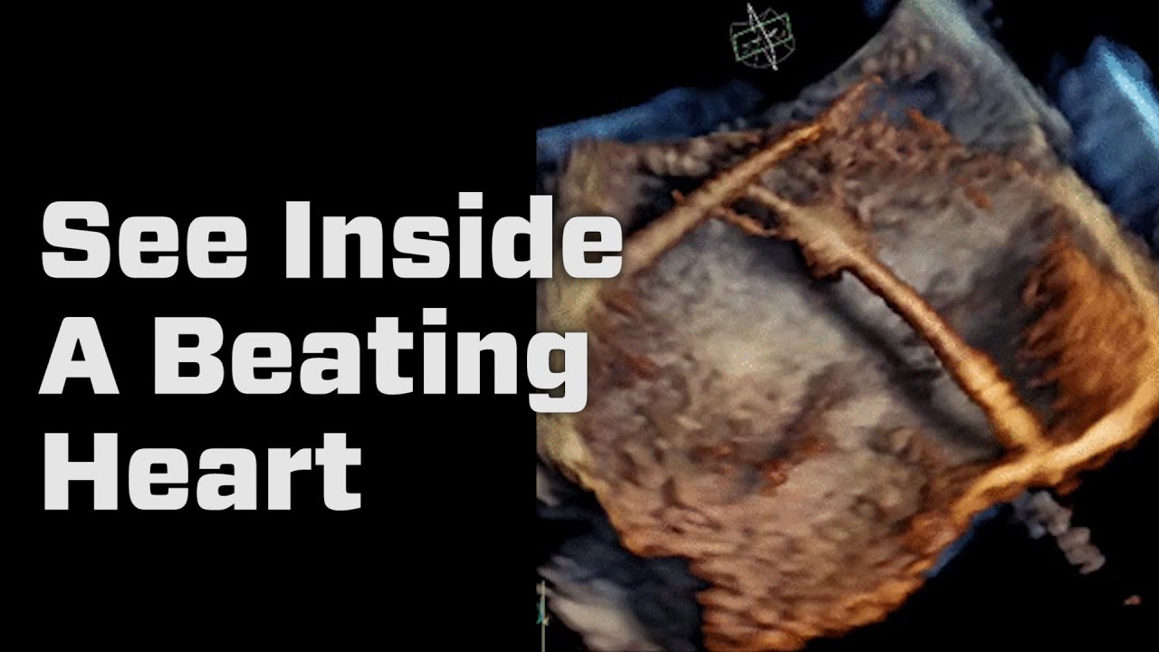 See Inside A Beating Heart