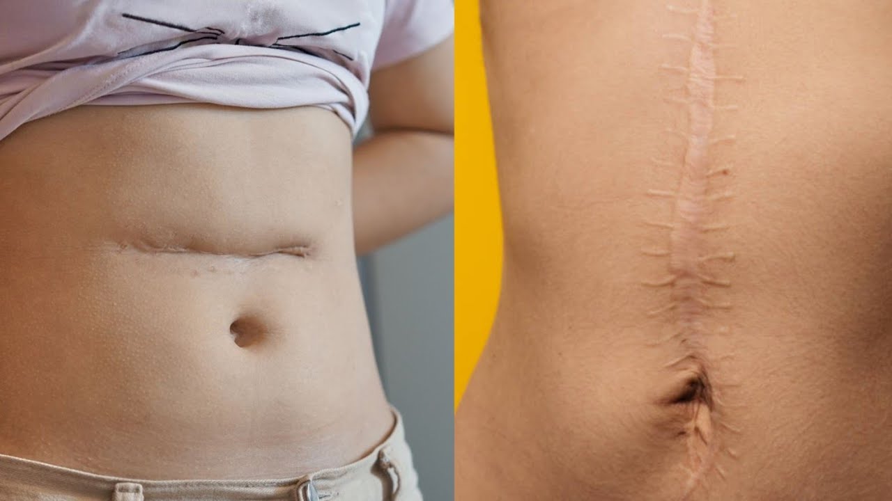 BARATANDUKANYE KUBERA YOUTUBE CHANNEL BIRABABAJE PEEE.