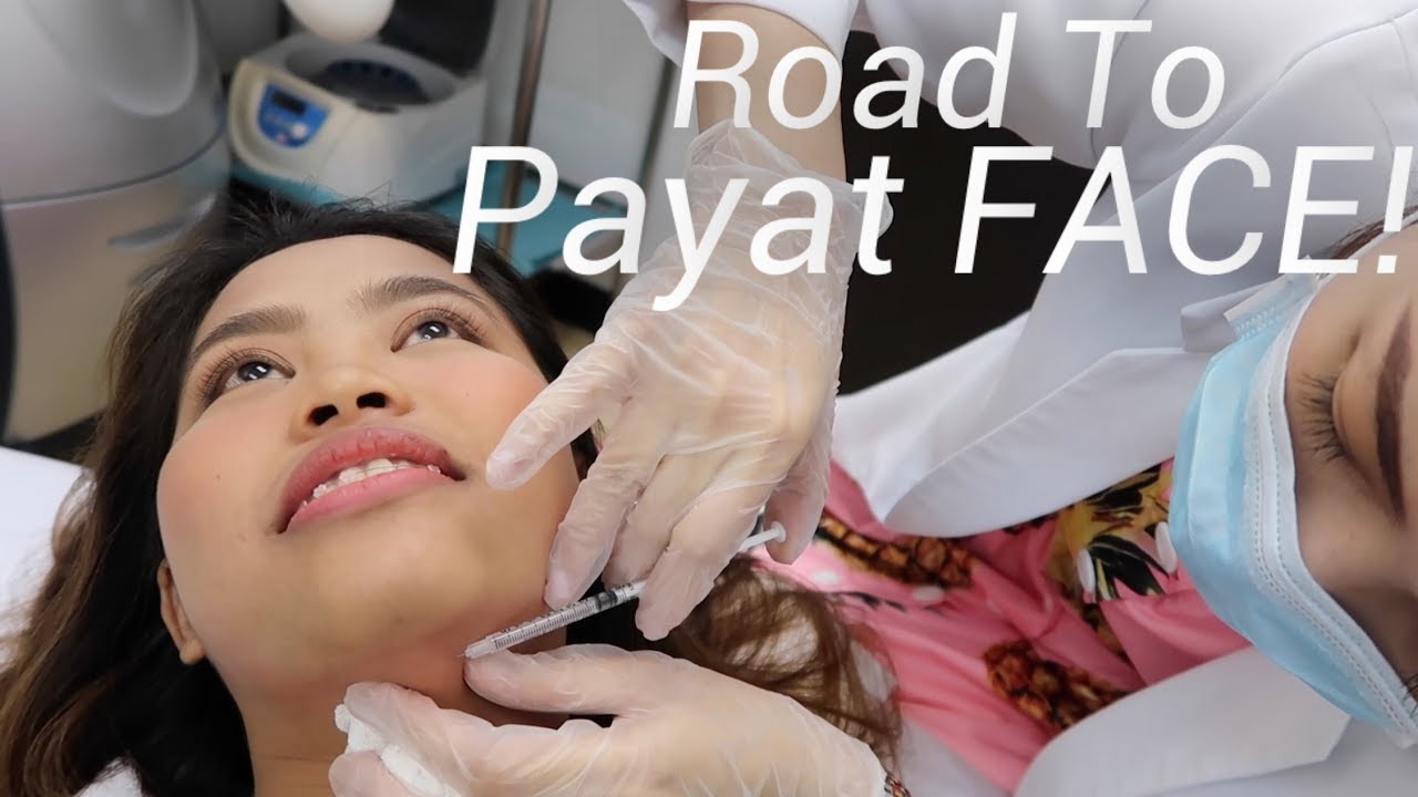 FACE SLIM UPDATE! (Effective Ba Talaga? REVIEW!)