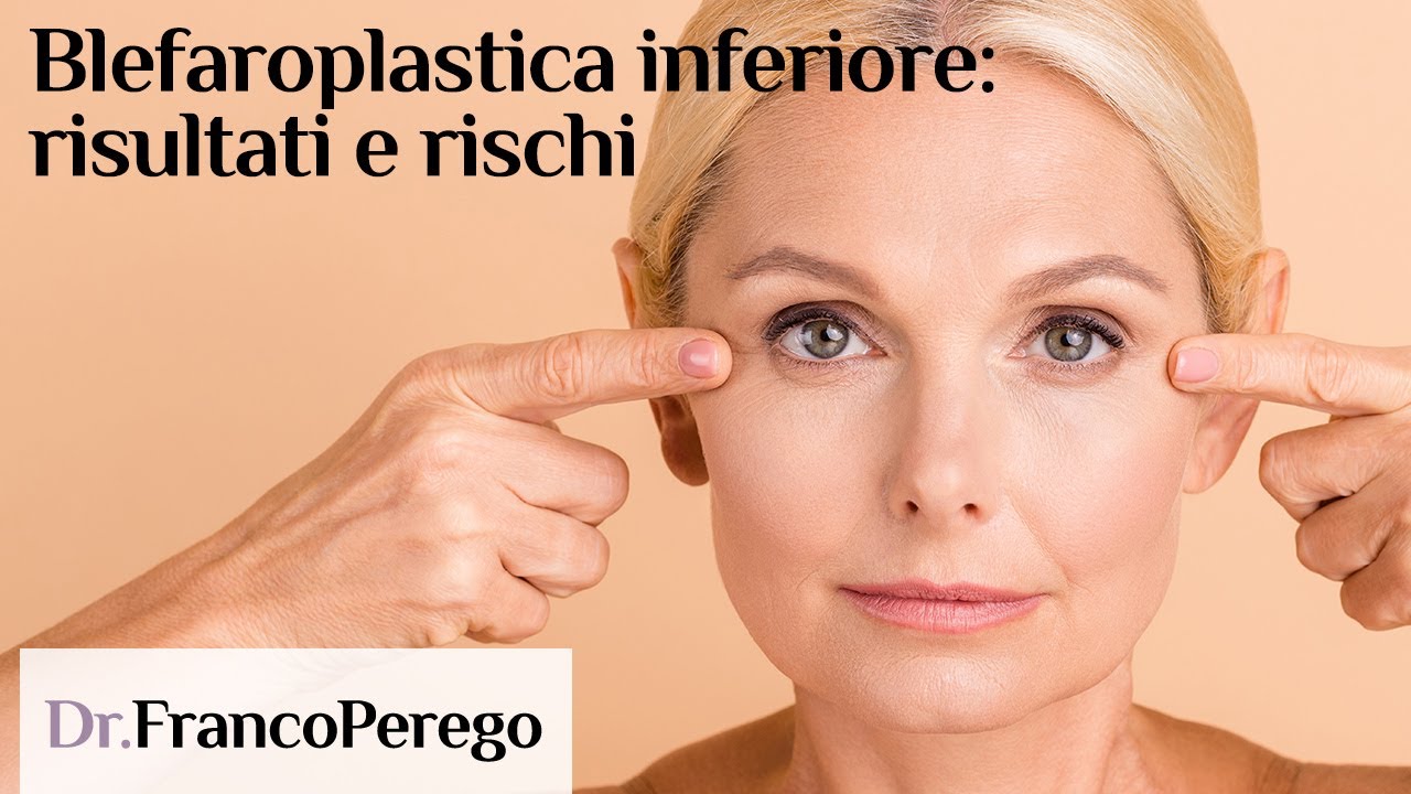 Blefaroplastica inferiore: risultati e rischi.