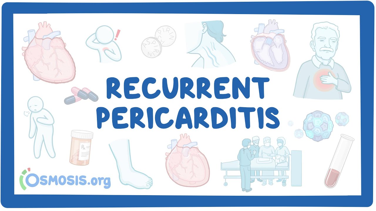 Recurrent Pericarditis (NORD)