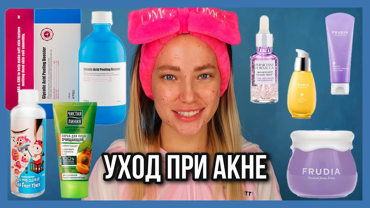 ПРОБЛЕМНАЯ КОЖА БЮДЖЕТНЫЙ УХОД | КОРЕЙСКАЯ КОСМЕТИКА | УХОД ОТ ПРЫЩЕЙ