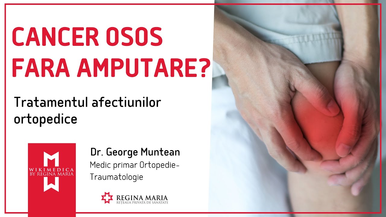 CANCER OSOS: Tratament Eficient Ce Evita Amputarea Membrului