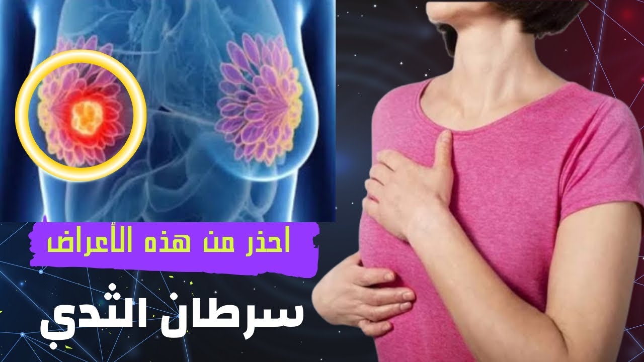 أعراض سرطان الثدي | احذري من وجود هذه العلامات التي تكشفه باكرا