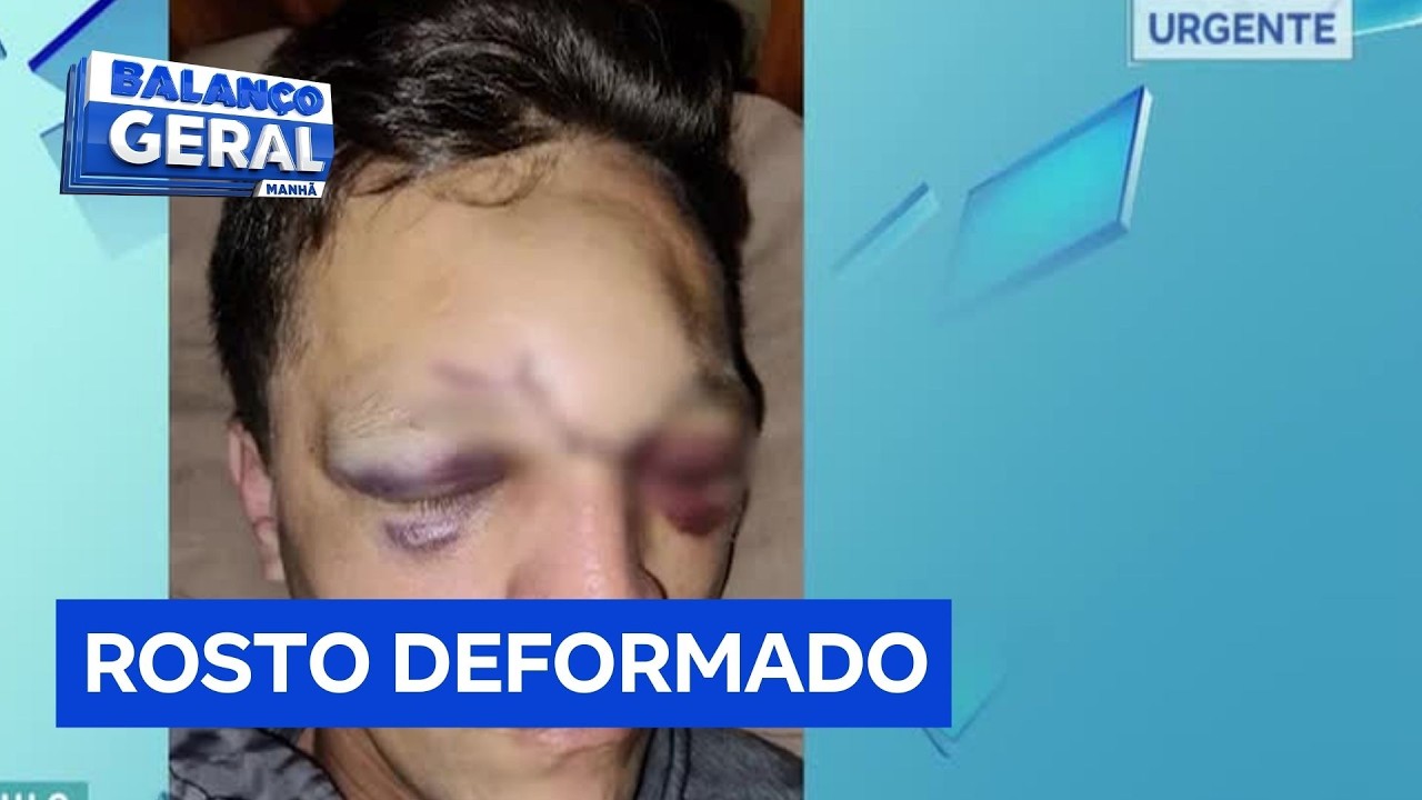 Motociclista fica ferido após ser atingido por linha cortante no interior de São Paulo