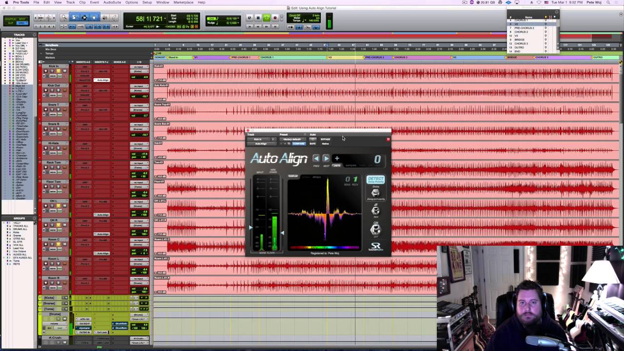 How To Use Auto Align by Sound Radix | MixBetterNow.com