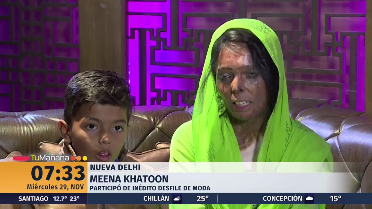 El valiente desfile de mujeres atacadas con ácido | 24 Horas TVN Chile