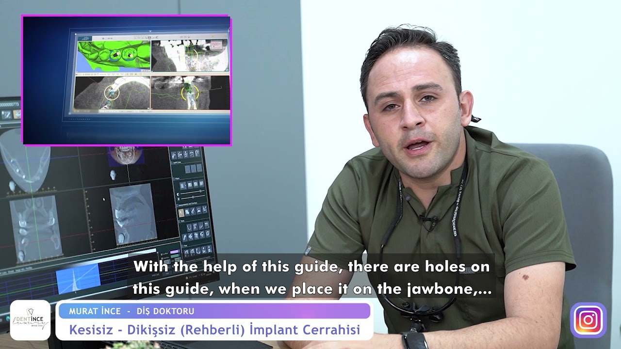 Dikişsiz İmplant Tedavisi Nasıl Yapılır?  - Dentince | Dr. Dt. Murat İnce