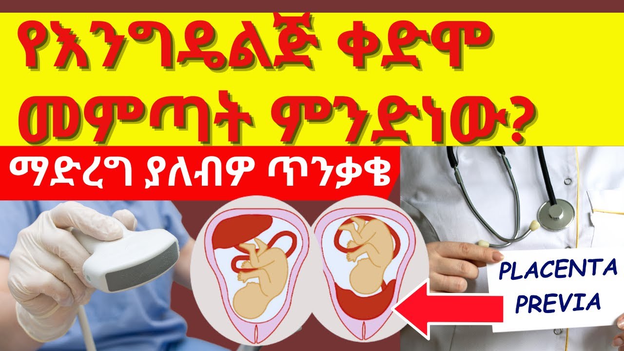 የእንግዴልጅ ቀድሞ ሲመጣ መደረግ ያለባቸው ጥንቃቄዎች/placenta previa፣ በእርግዝና ጊዜ ደም መፍሰስ/vaginal bleeding during Px