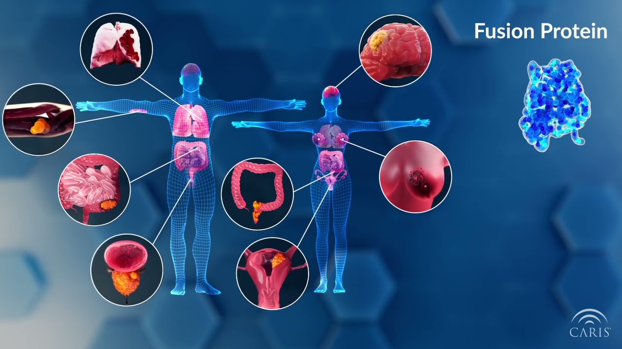 What is Gene Fusion?