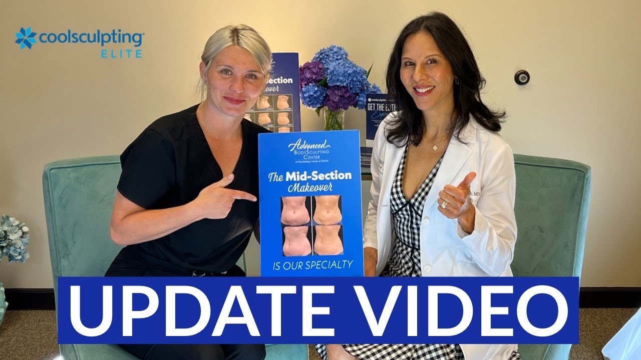 AMAZING CoolSculpting ELITE Results - Update & Progress Report