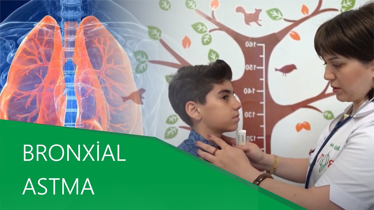 Bronxial astmanın hormonal dərmansız müalicəsi mümkündür! Biotənzimləyici terapiyanın effekti