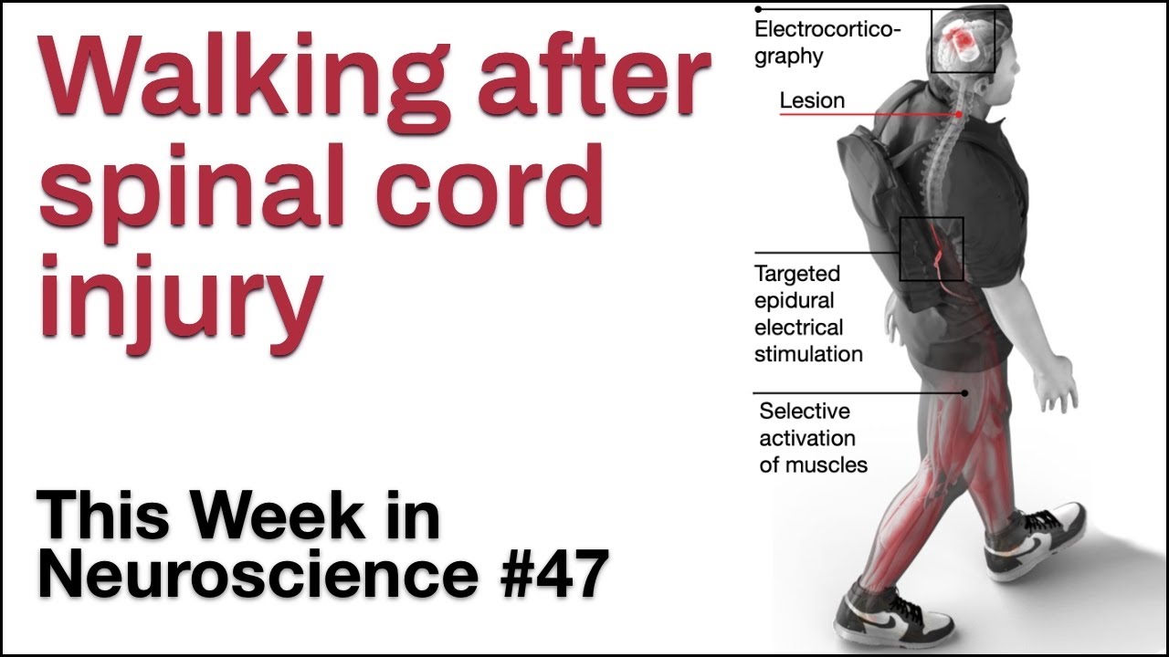 TWiN 47: Walking after spinal cord injury
