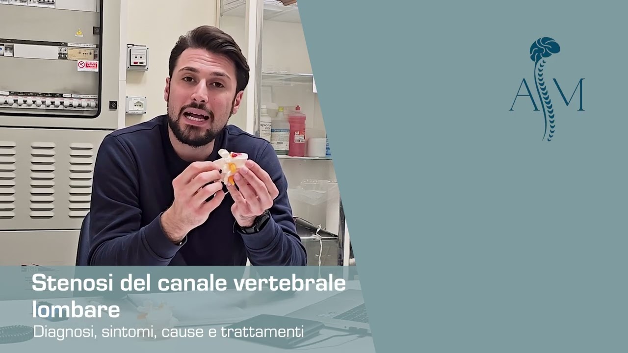 La stenosi: restringimento del canale vertebrale - Dott. Antonio Musio #neurochirurgo #stenosi