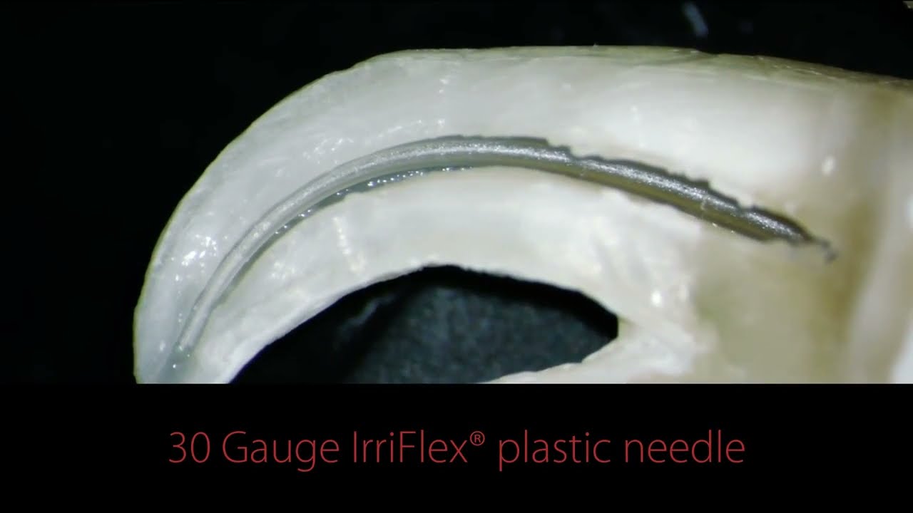 IrriFlex® Join the glide cleaning revolution (Irrigation Revolution)