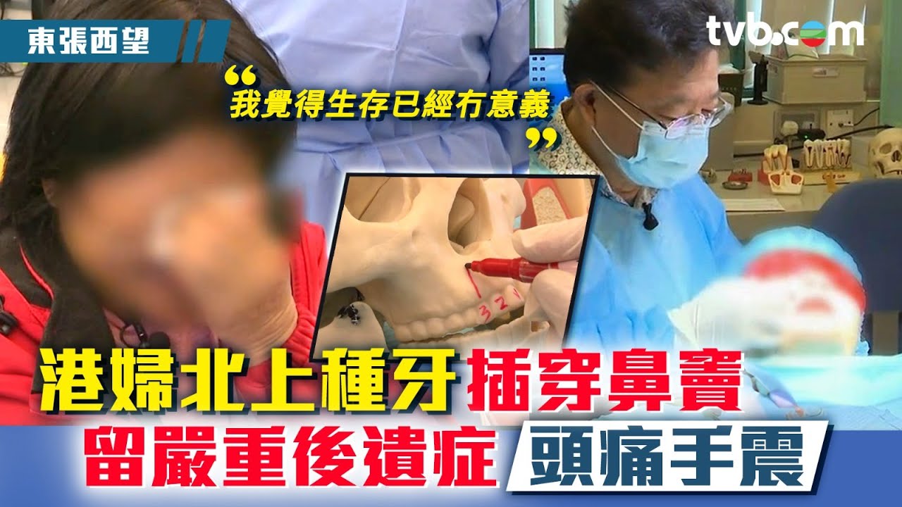 東張西望｜港婦北上種牙插穿鼻竇 留嚴重後遺症頭痛手震