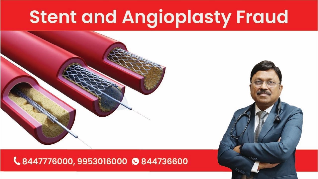 Stent and Angioplasty Fraud