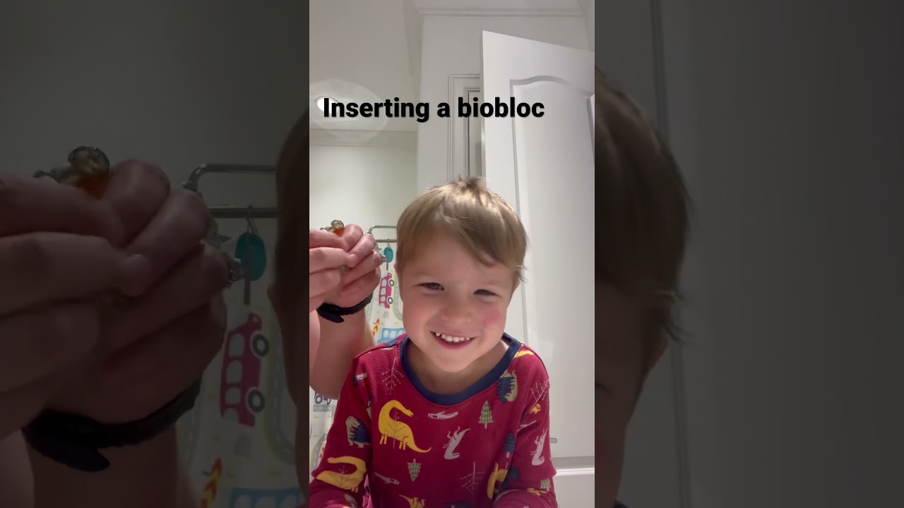 Inserting a biobloc