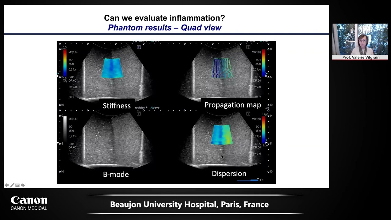 AIUM 2021 - Canon Medical's Solution Showcase - Liver analysis package