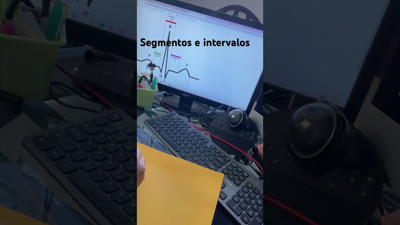 #EKG#segmentos#intervalos