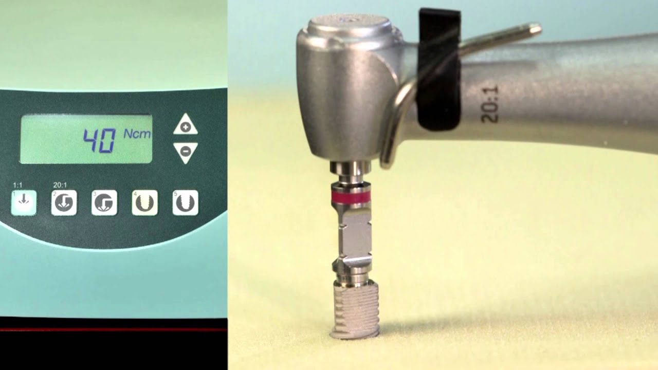 V3 Insertion Torque Test