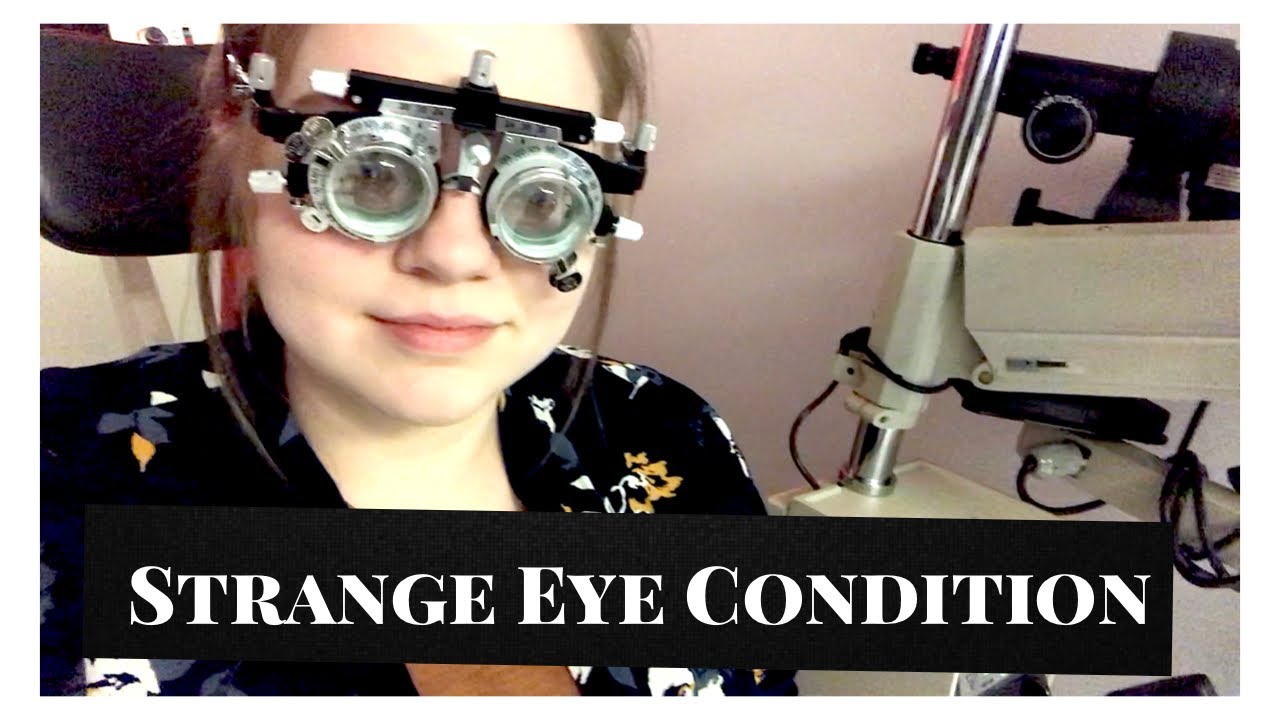 Doctor Visit | Strange eye condition | Gas Perm Contacts