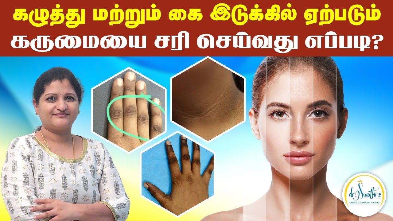 கழுத்து மற்றும் கை இடுக்கில் ஏற்படும் கருமையை சரி செய்வது எப்படி? | Darkness under Arm | Dr Swathika