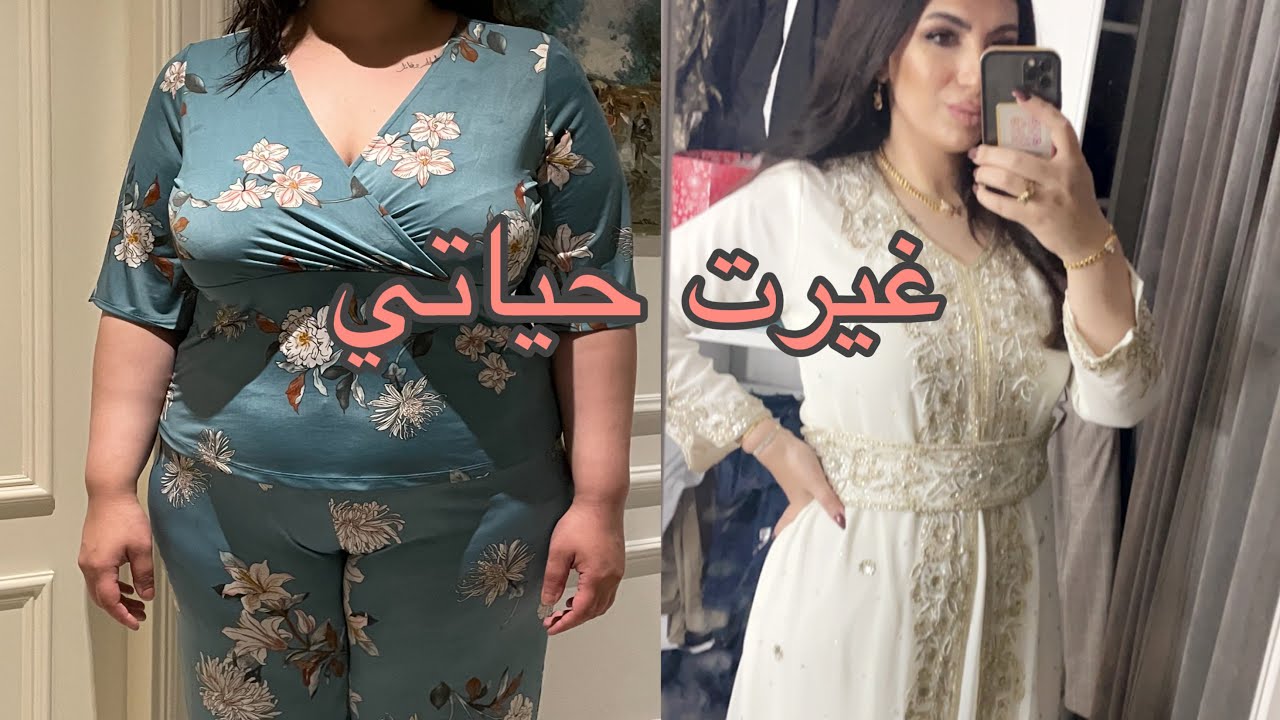 رحلتي مع تكميم المعده - أورام المعده - نزلت ٣٠ كيلو