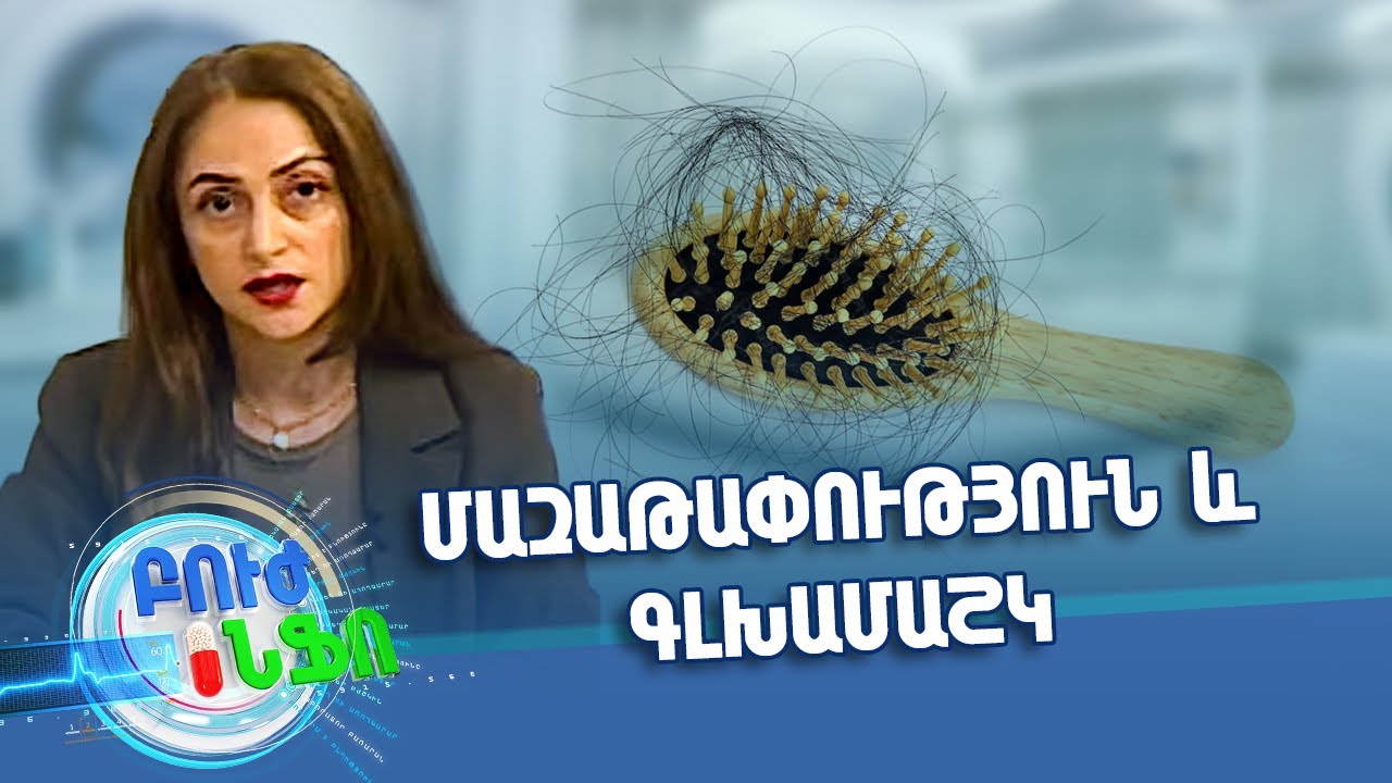 Մազաթափություն և գլխամաշկ / Խորհուրդ մասնագետից / Բուժ ինֆո / Buj Info