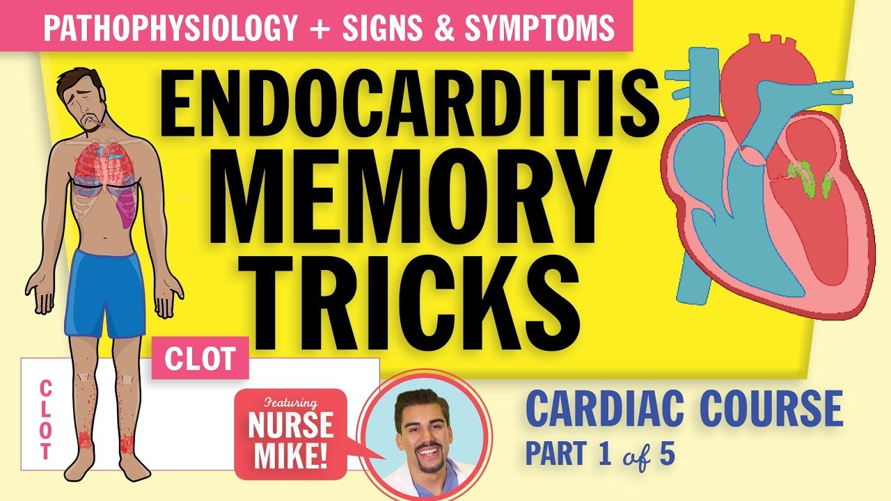 Endocarditis Pathophysiology, signs and symptoms for nursing students   NCLEX review