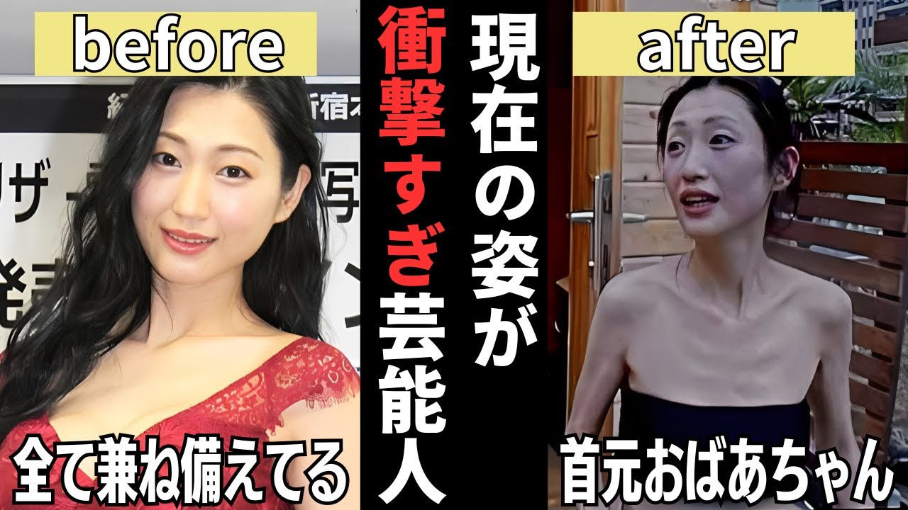 【有益2ch】あの人がこんな姿に!?現在の姿が衝撃すぎる芸能人ビフォーアフター【ガルちゃん】