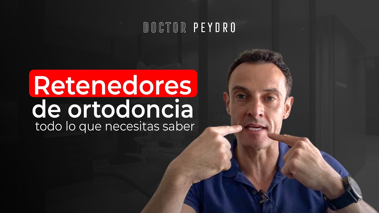 Retenedores de ortodoncia: ¿Cómo funcionan?