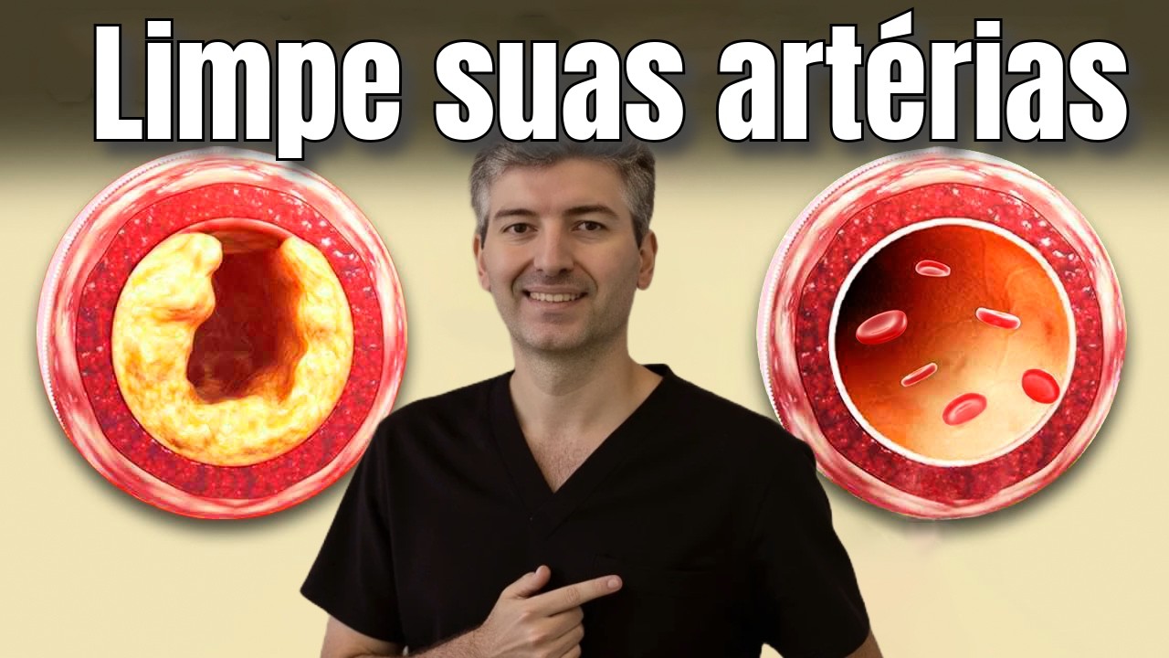 Artérias ENTUPIDAS? 6 Passos Comprovados Para LIMPAR o CÁLCIO e Salvar Seu Coração