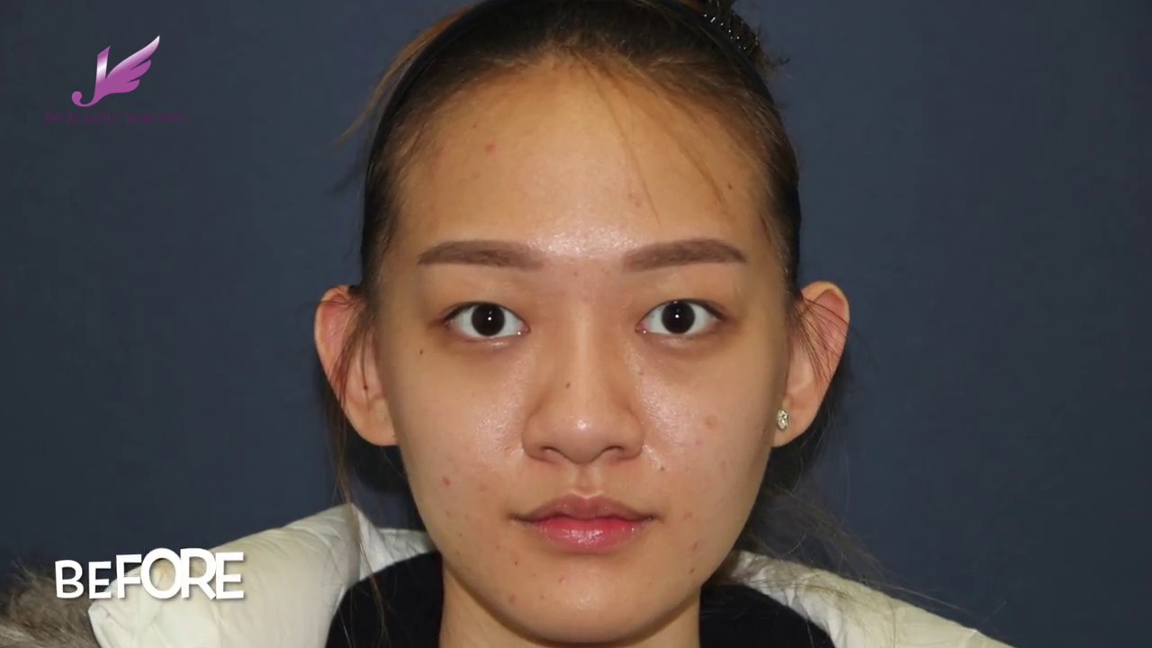 [JW Plastic Surgery Center] Before and after pictures of plastic surgeries