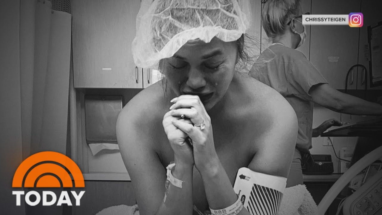 Chrissy Teigen Shares Emotional Story Of Losing Her Baby | TODAY