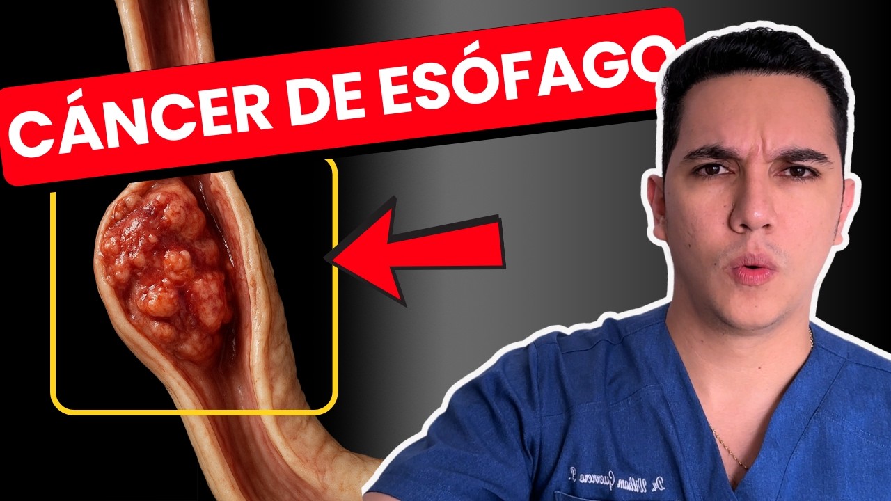Cuando tragar duele: primeras señales del cáncer de esófago